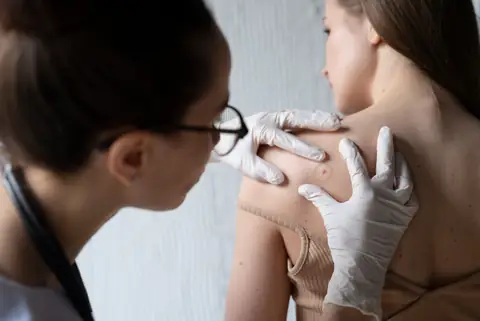 Here’s Everything You Need to Know About Lyme Disease