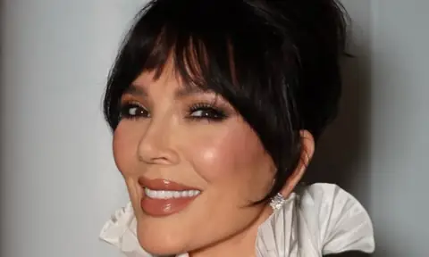 Kris Jenner Reveals Her Friends Need “Secret Password” to See Her Plastic Surgeon
